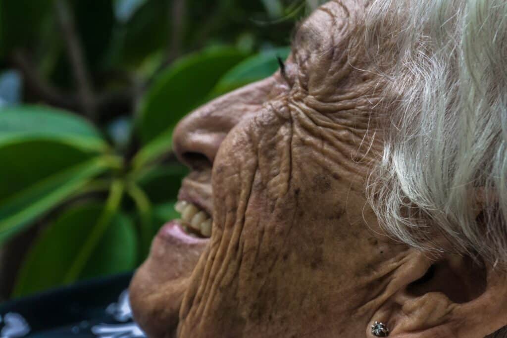 קמטוטים: סימני הזדקנות העור